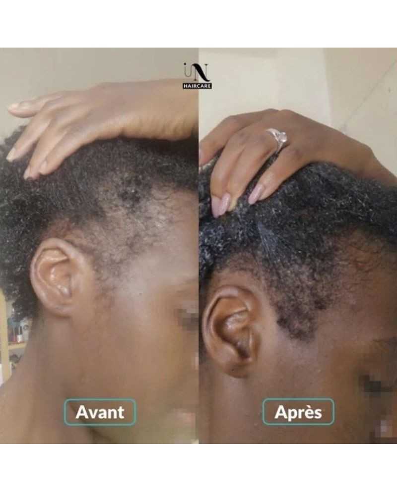 Gélules Pousse Cheveux Fortification & Volume - In Haircare