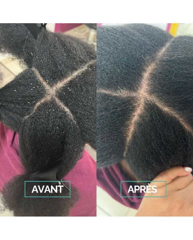 Gelée Détox Exfoliant Cuir Chevelu 200 ml - In Haircare