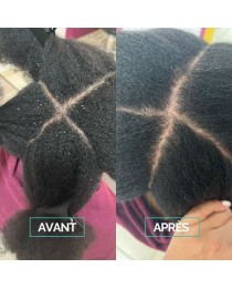 Gelée Détox Exfoliant Cuir Chevelu 200 ml - In Haircare