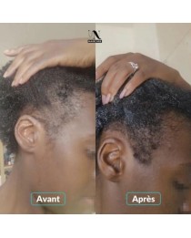 Gélules Pousse & Volume - Cure 6 mois | In Haircare