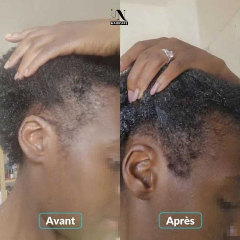 Routine complète Pousse de Cheveux 3 mois - In Haircare (In & Out)