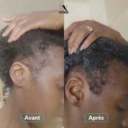 Routine complète Pousse de Cheveux 3 mois - In Haircare (In & Out)