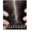 Cuir chevelu à pellicules