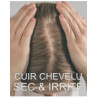 Cuir chevelu sec & irrité